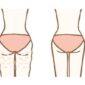 cellulite tissus cutanes