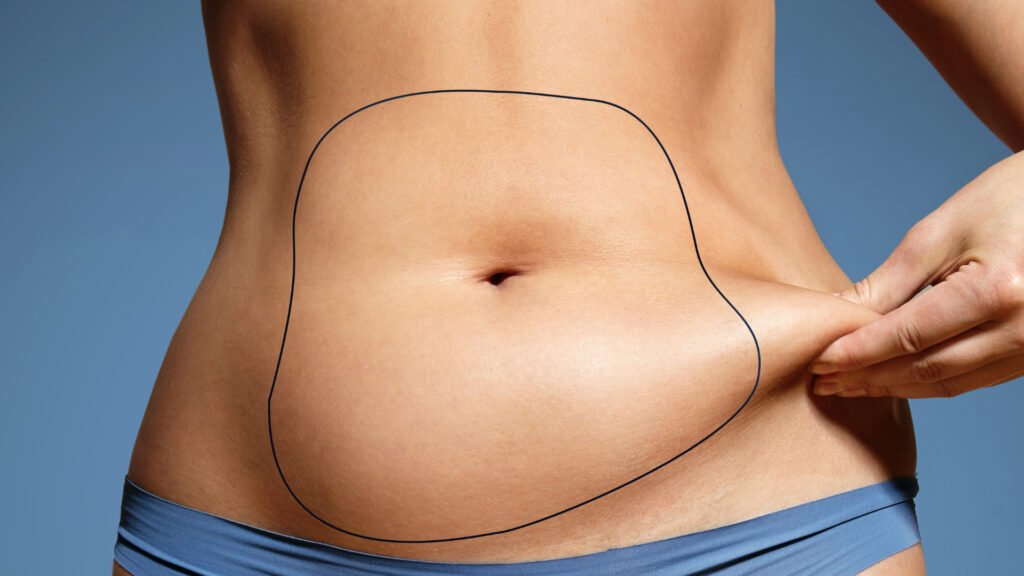 lipo ventre 01