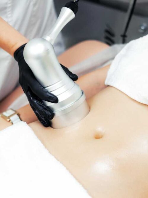 vakuumnyj massazh tela 500x669 1