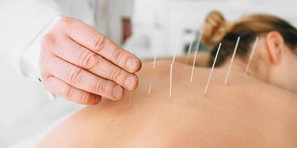 métalothérapie et acupuncture